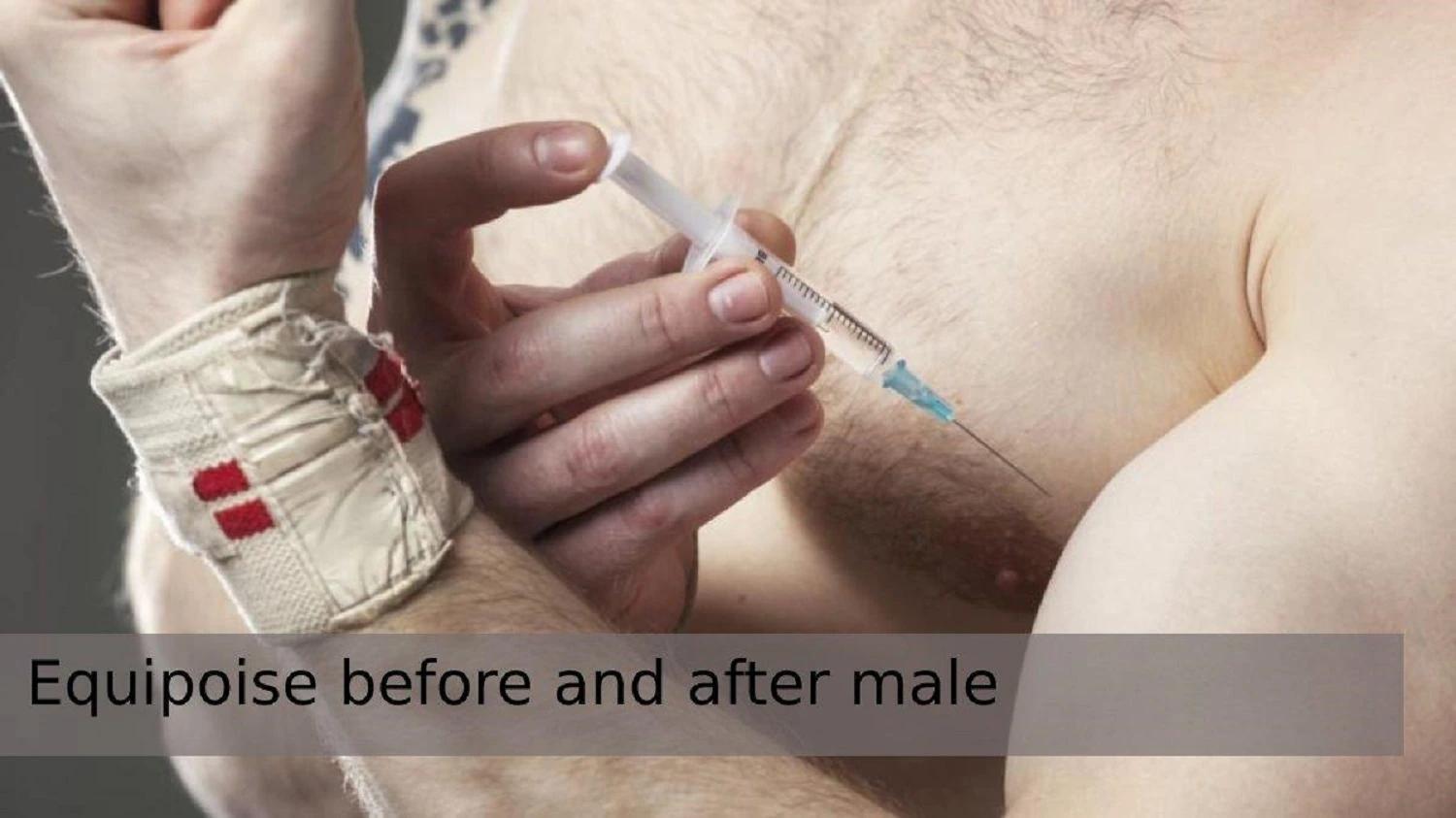Equipoise before and after male